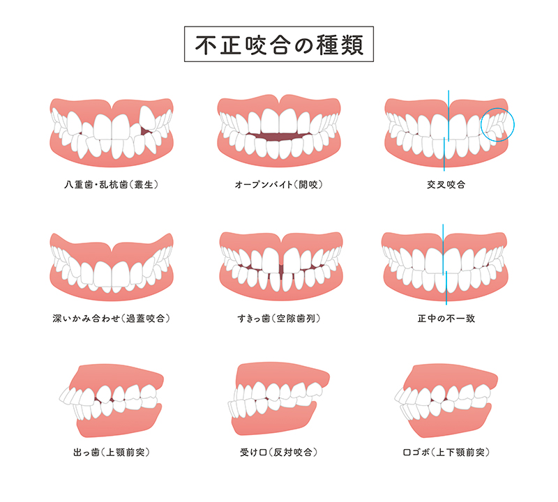 矯正治療